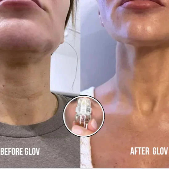 Système de micro-infusion Whov